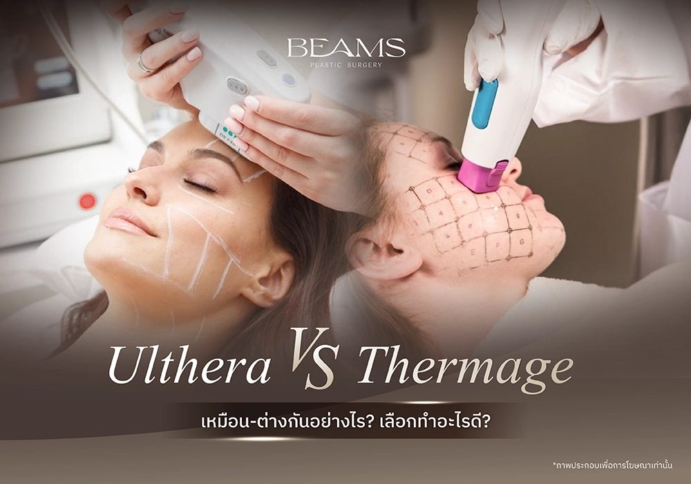 ulthera vs thermage แตกต่างกันอย่างไร?