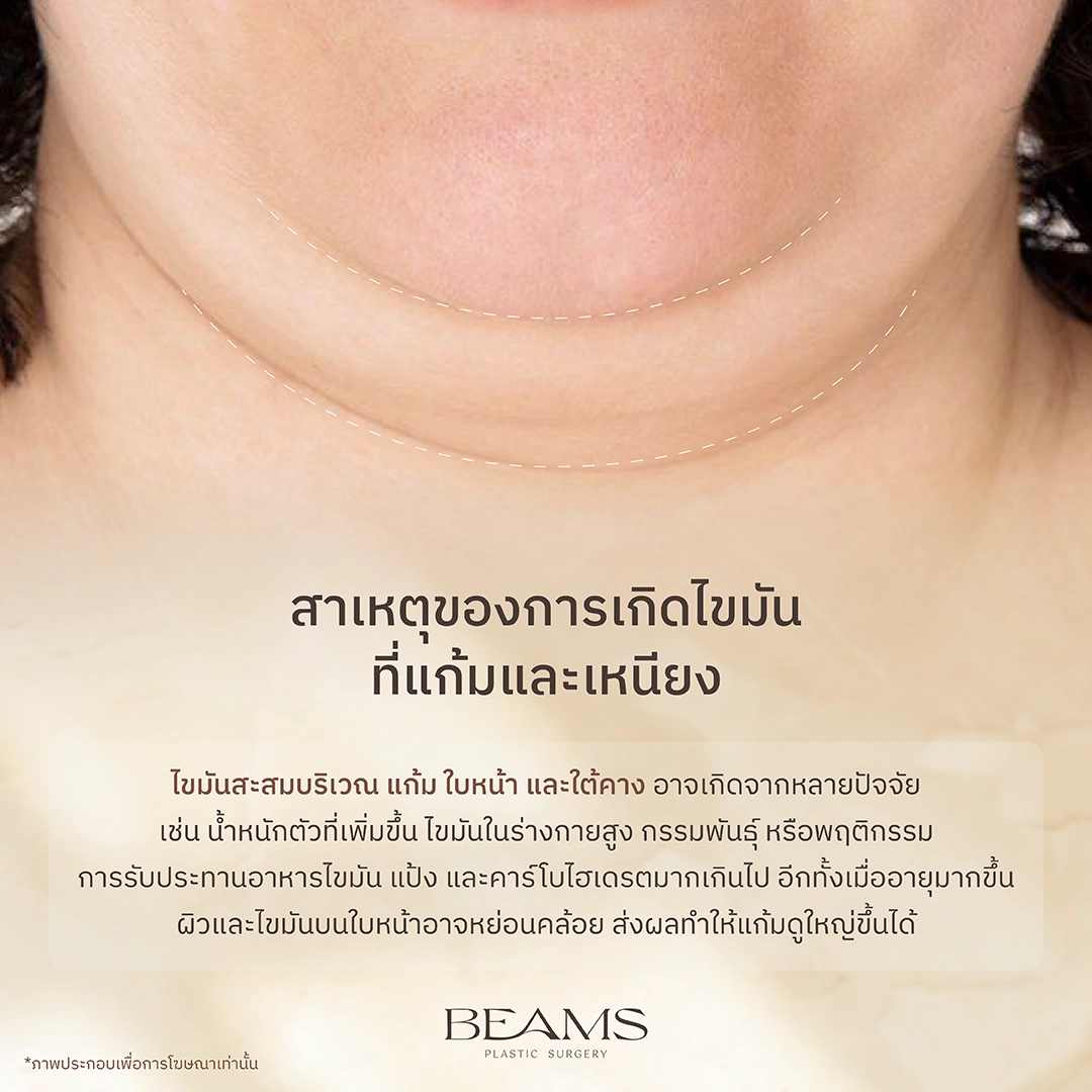 สาเหตุของไขมันที่แก้มและเหนียง