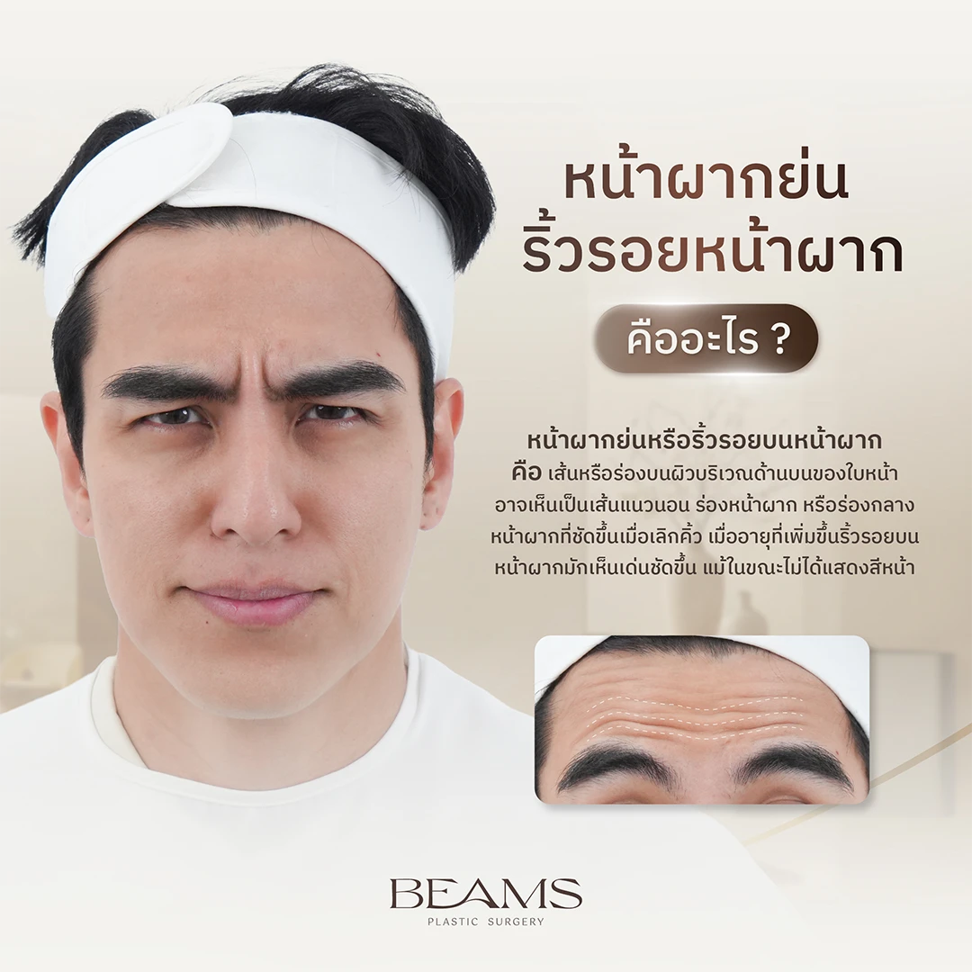 หน้าผากย่น คืออะไร