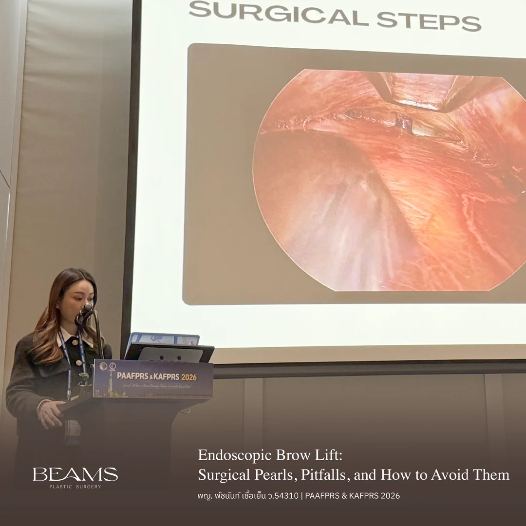 เปิดเทคนิคส่องกล้องยกคิ้ว กับคุณหมอใบหม่อน