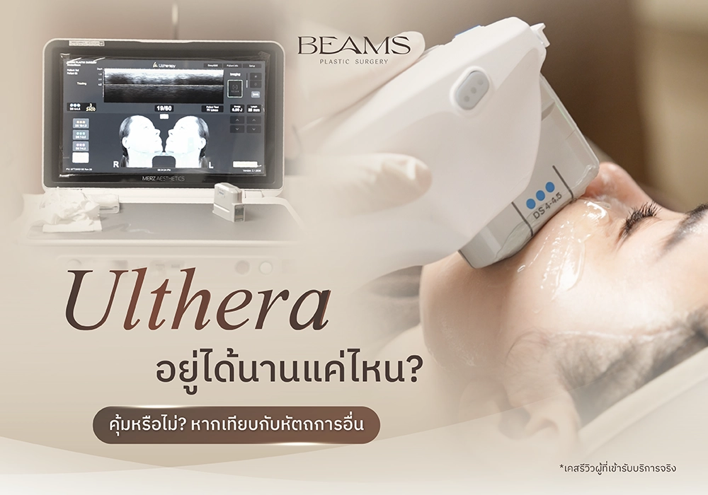 Ulthera อยู่ได้นานแค่ไหน