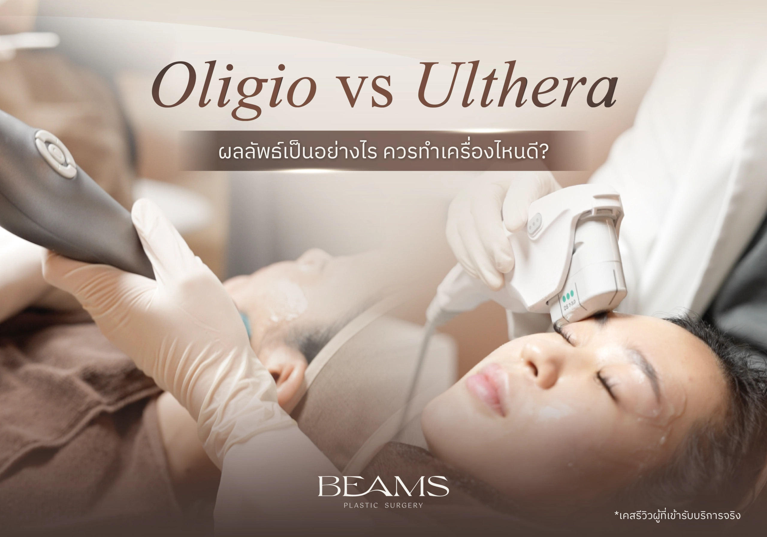 Oligio กับ Ulthera