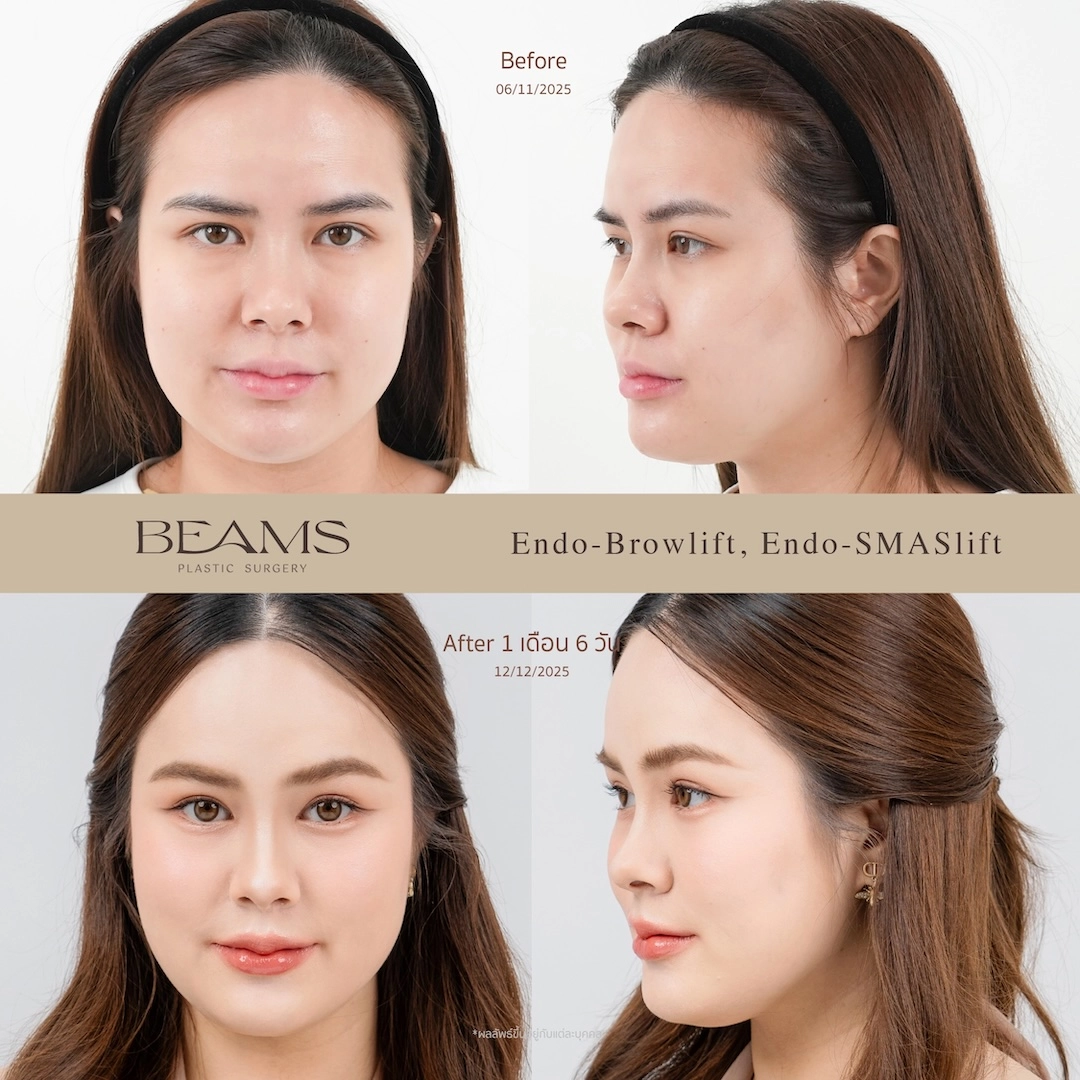 review-k-linlee