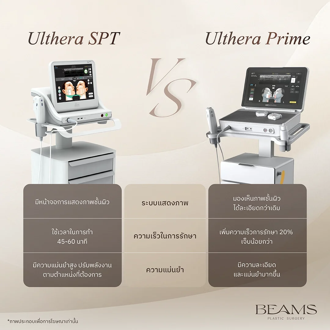 Ulthera SPT vs Ulthera Prime