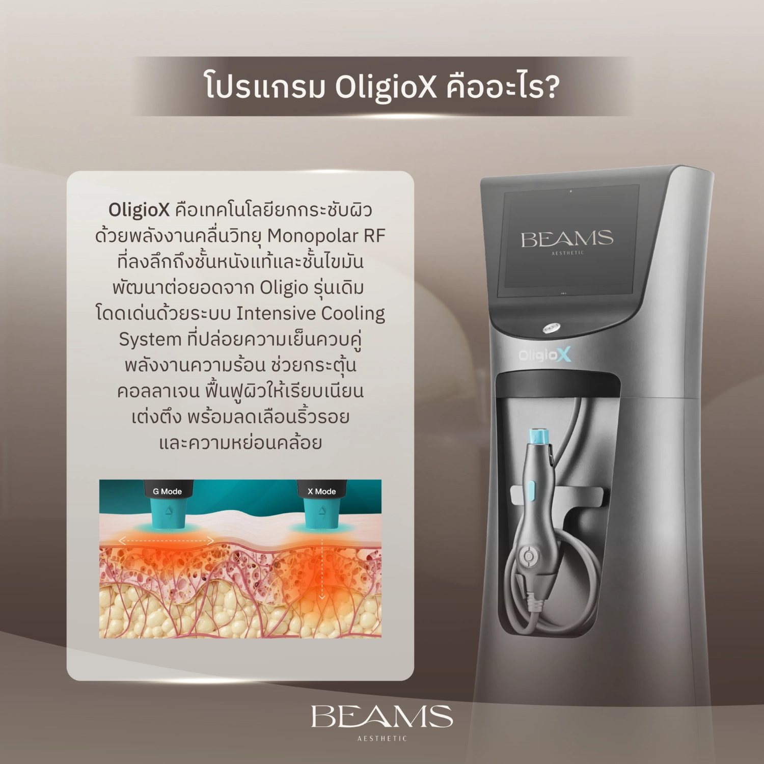 โปรแกรม OligioX คืออะไร