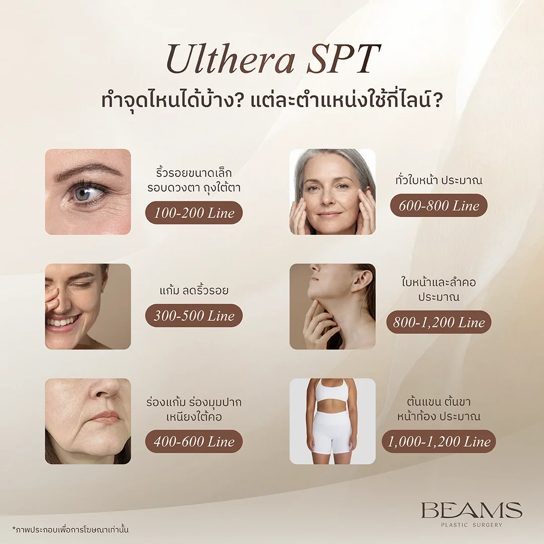 Ulthera SPT ทำจุดไหนได้บ้าง