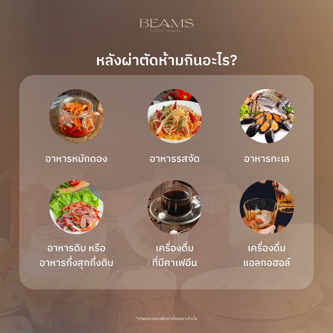 อาหารแสลงหลังผ่าตัด
