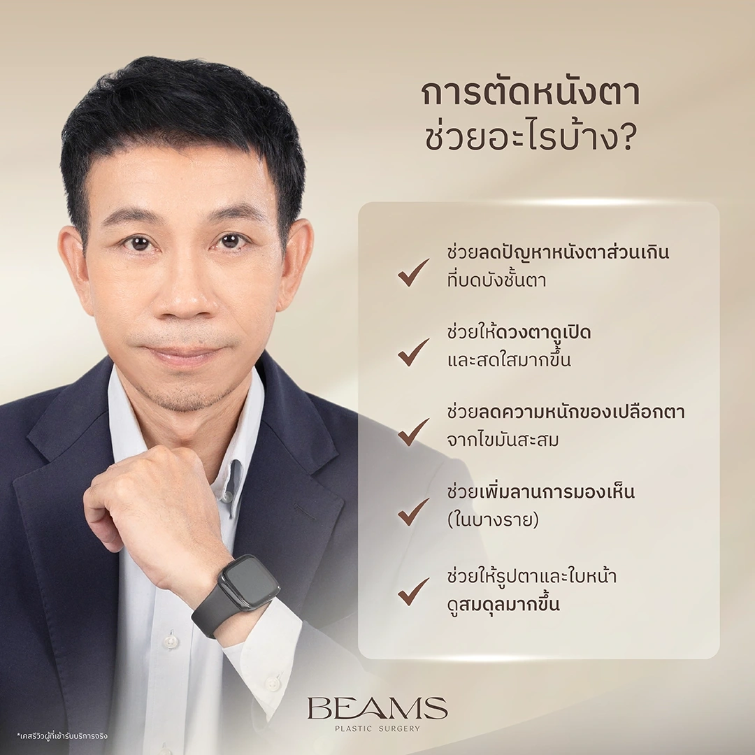 ข้อดีของการตัดหนังตา