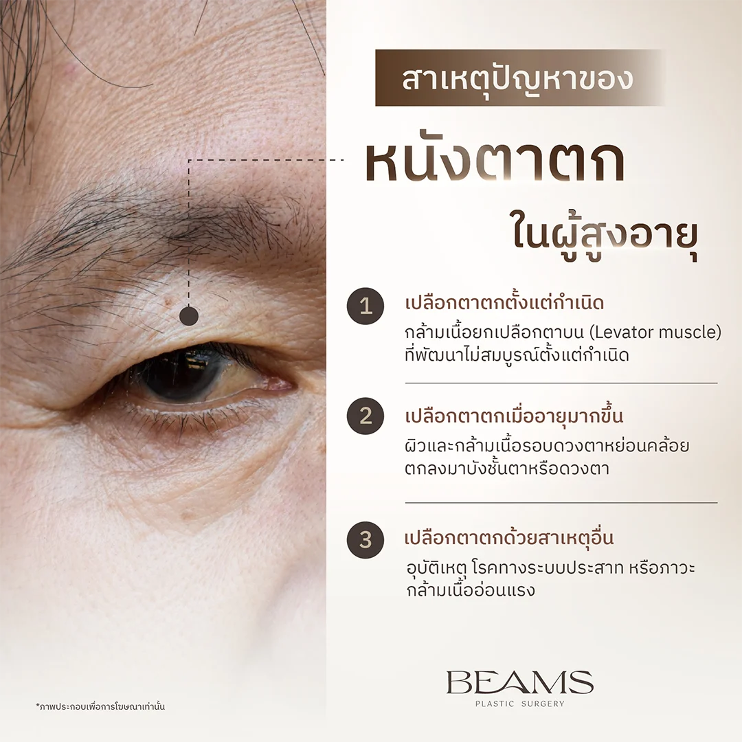 สาเหตุหนังตาตกในผู้สูงอายุ