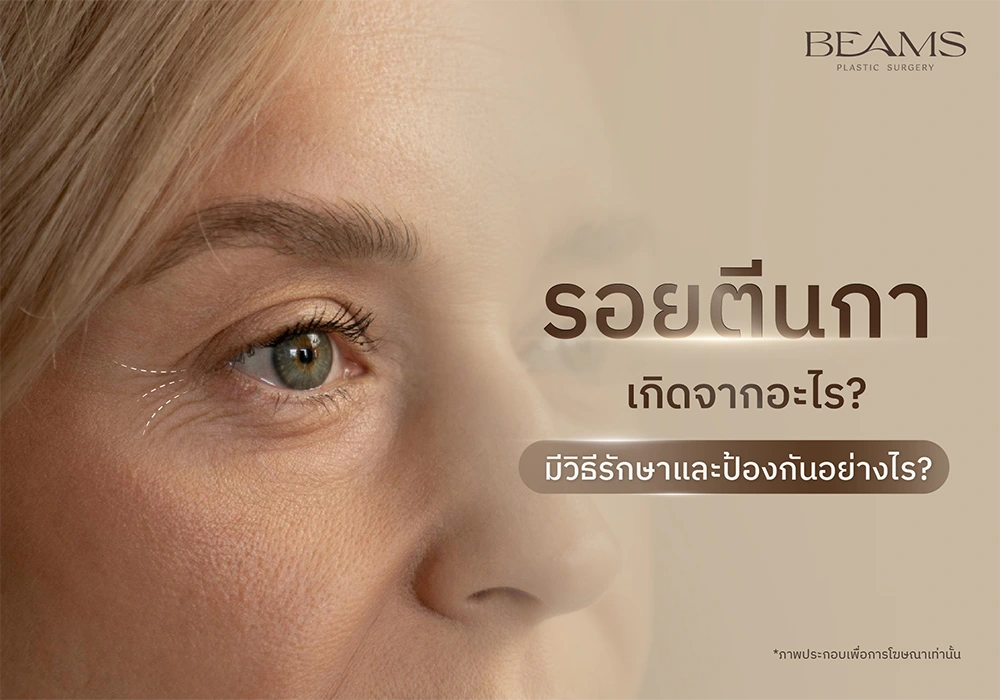ตีนกาเกิดจากอะไร