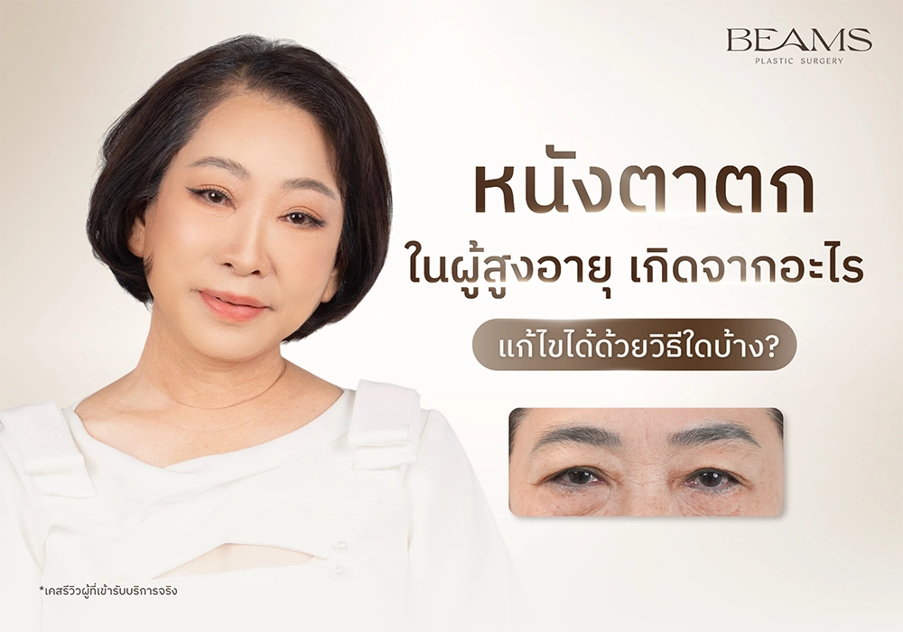 หนังตาตกในผู้สูงอายุ
