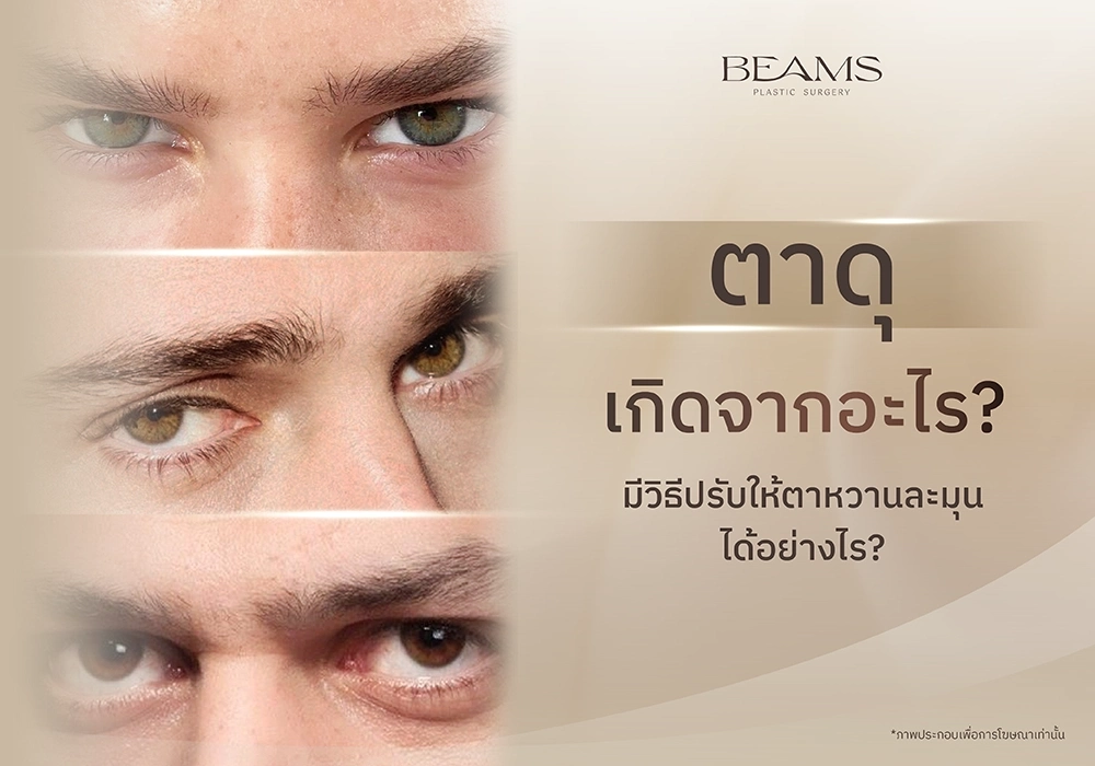 ปัญหาตาดุ