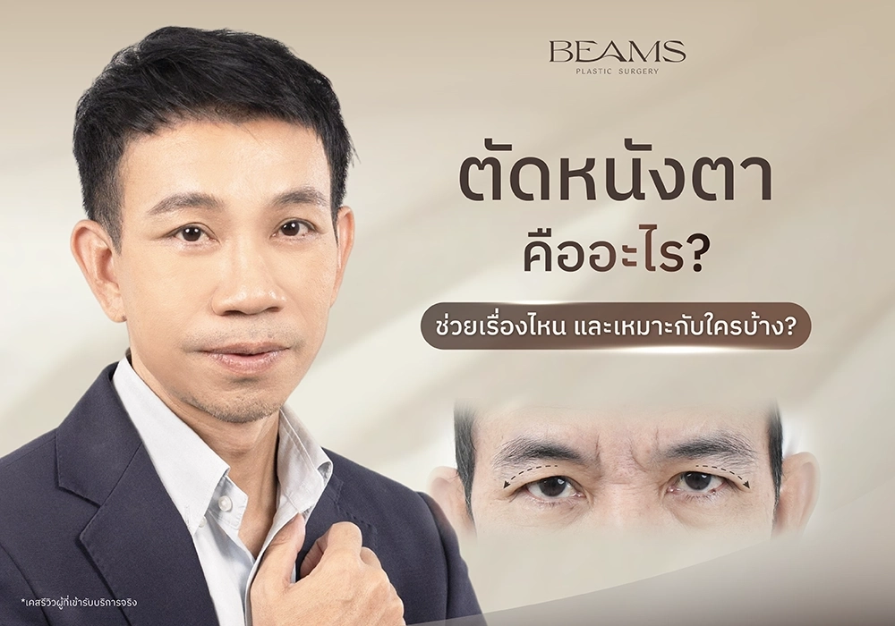 ผ่าตัดหนังตา