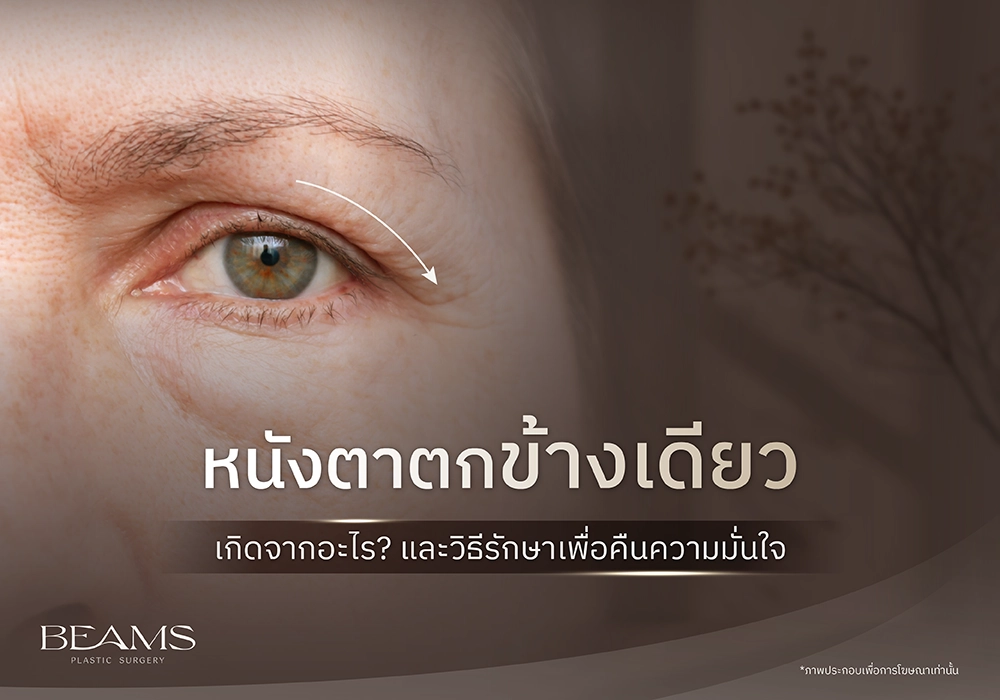 หนังตาตกข้างเดียวเกิดจากอะไร