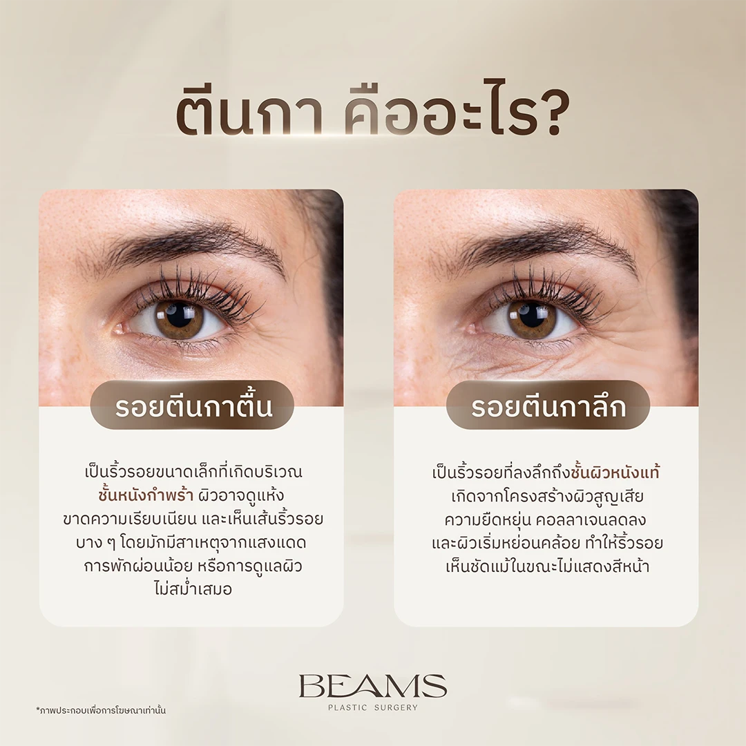 ตีนกา คืออะไร