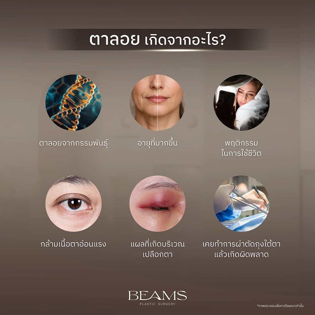 ตาลอย เกิดจากอะไร