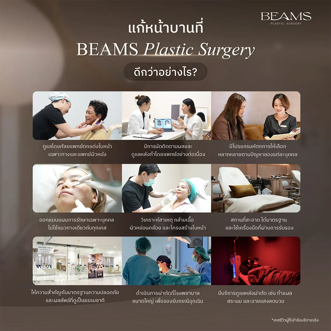 แก้หน้าบานที่ BEAMS Plastic Surgery