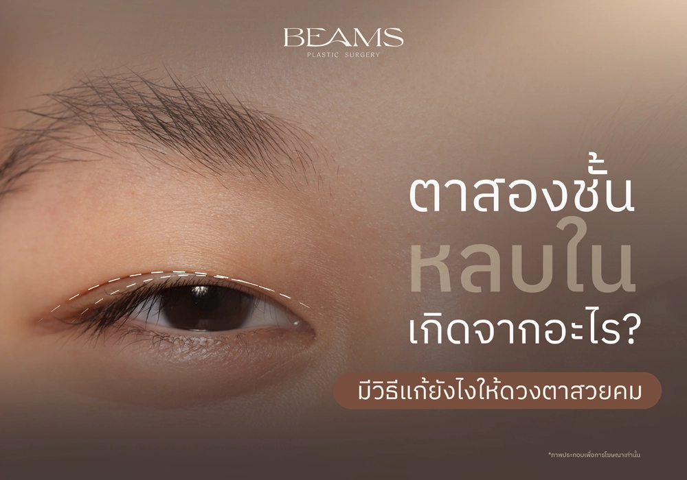ตาสองชั้นหลบใน