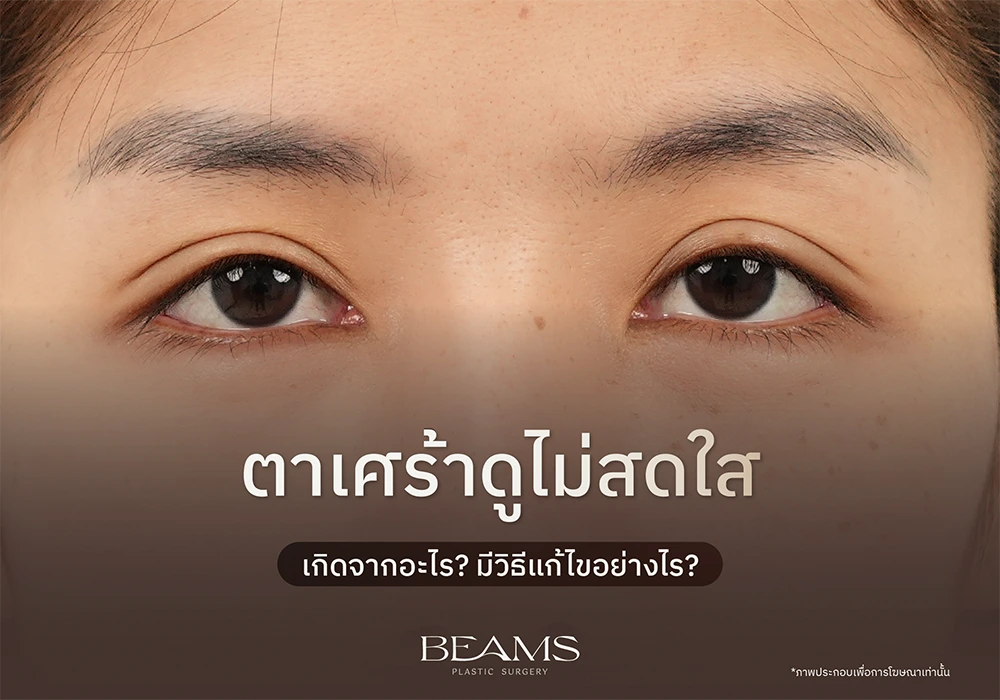 ตาเศร้า ไม่สดใส