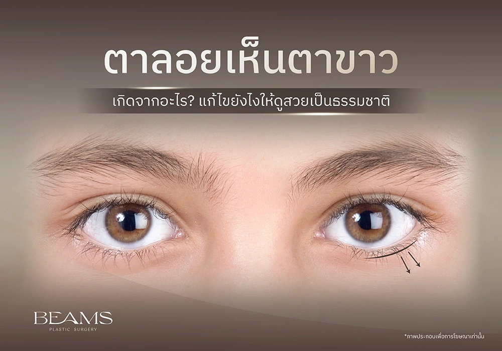 ตาลอย