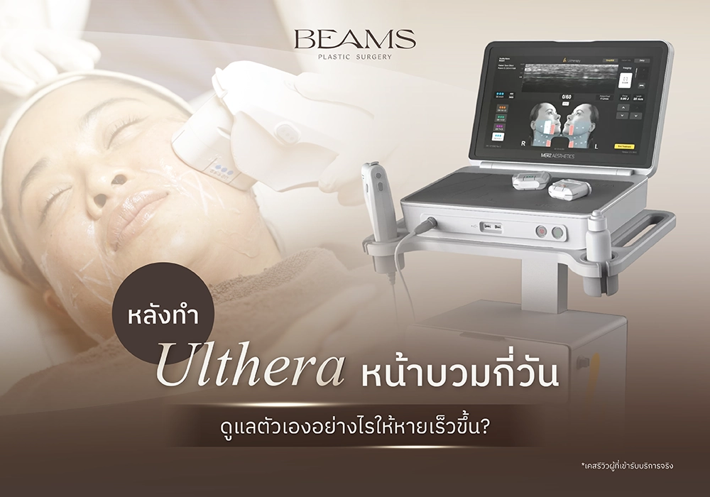 หน้าบวมหลังทำ ulthera