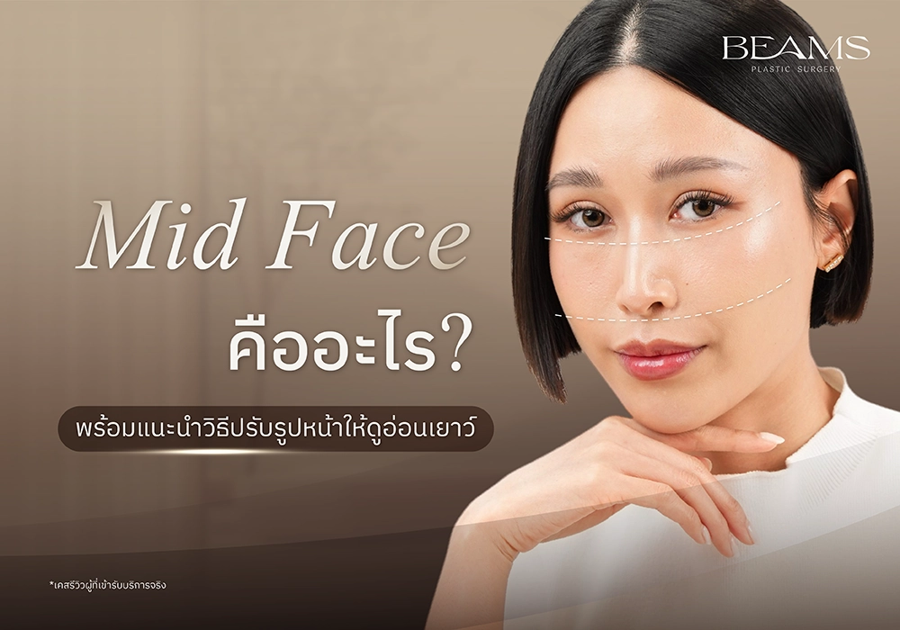 Midface คืออะไร