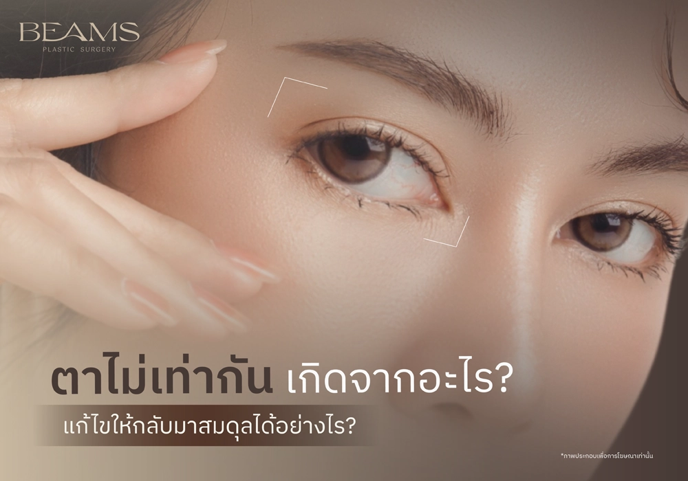 ตาไม่เท่ากันคืออะไร