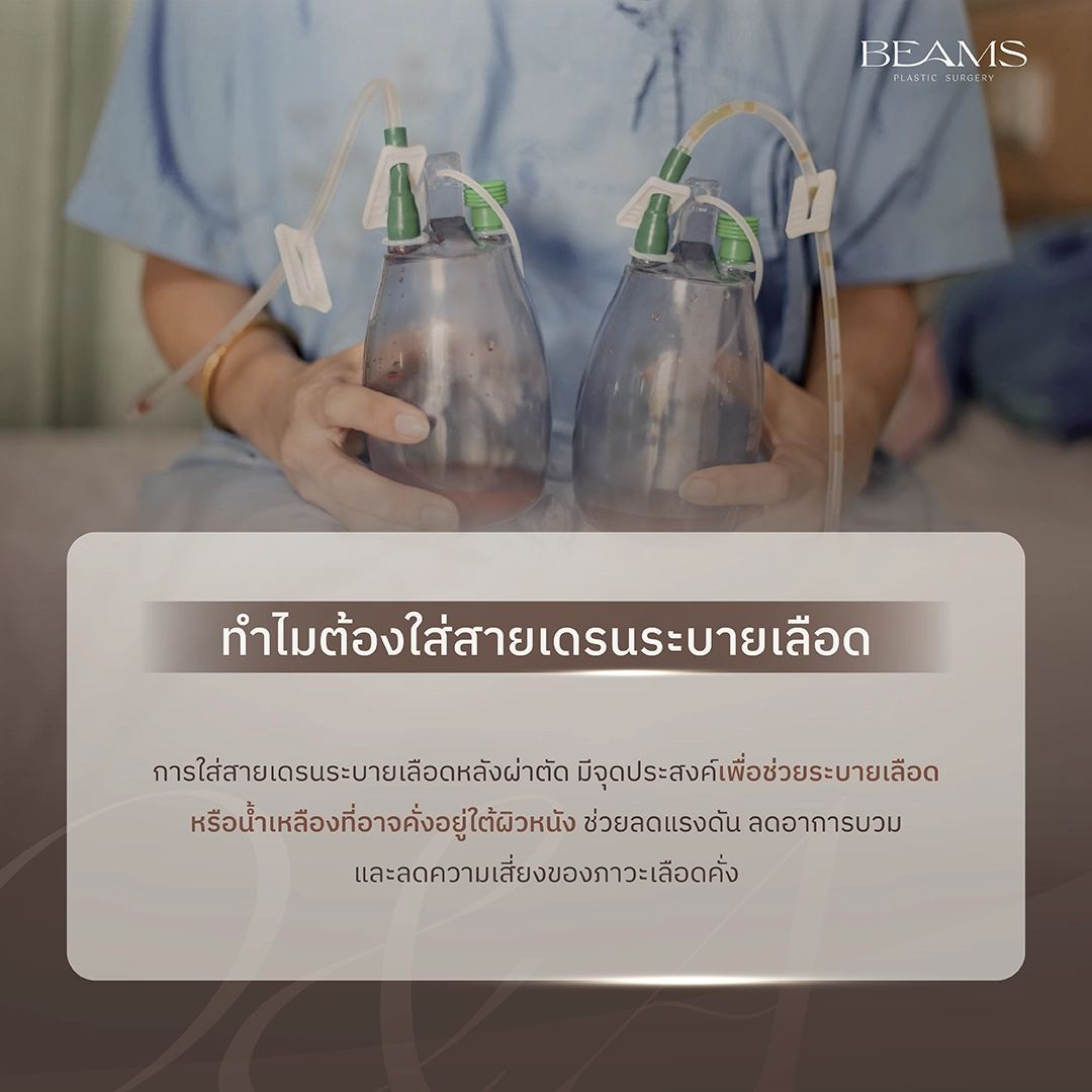 สายเดรนเลือด