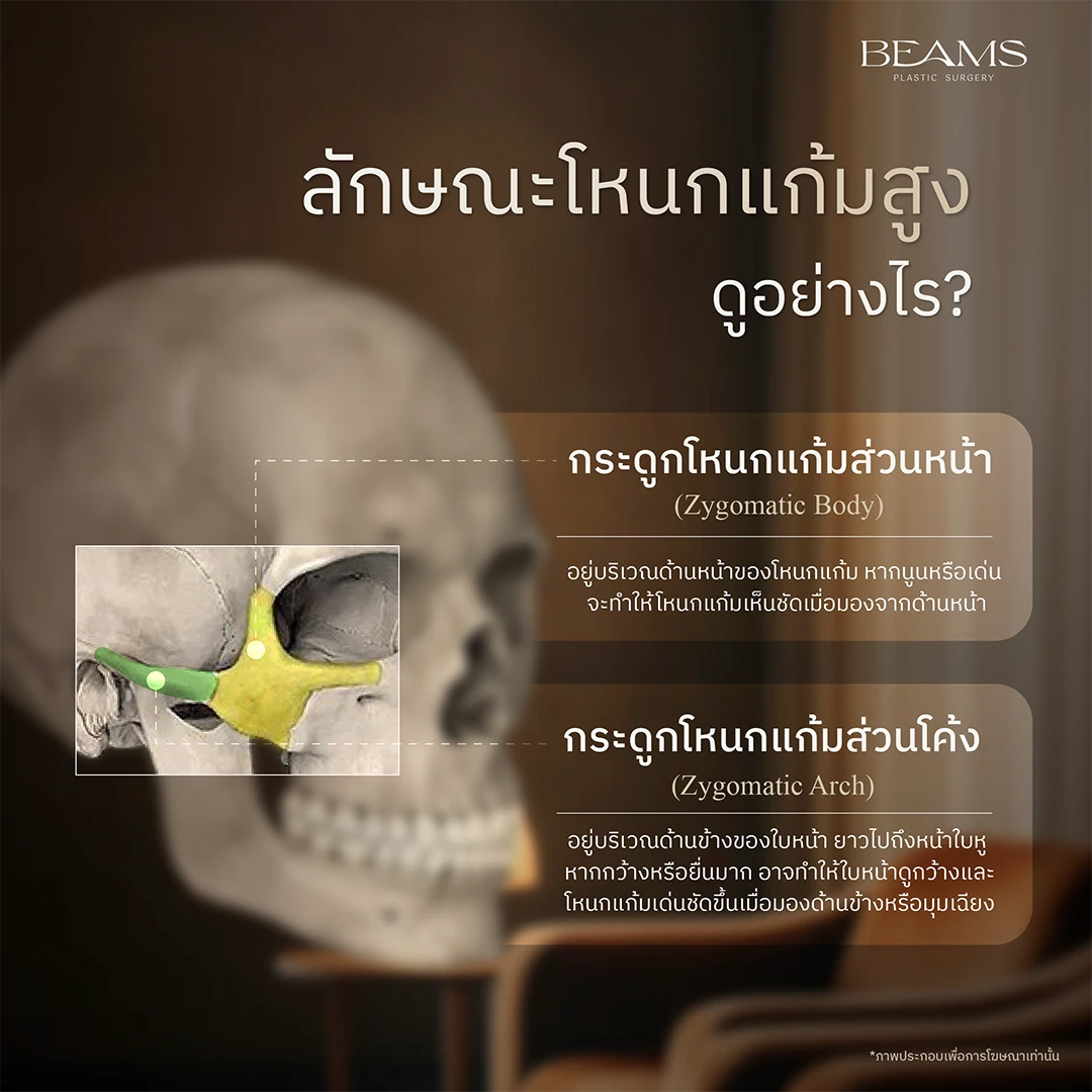ลักษณะโหนกแก้มสูง