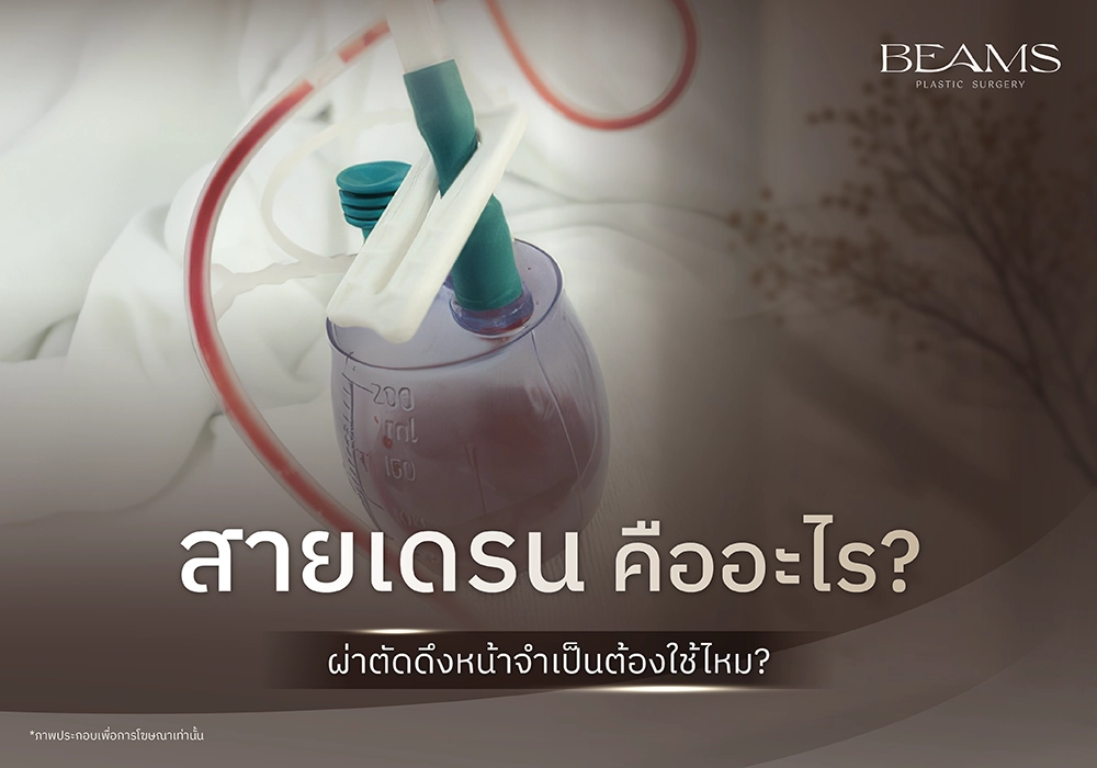 สายเดรนคืออะไร