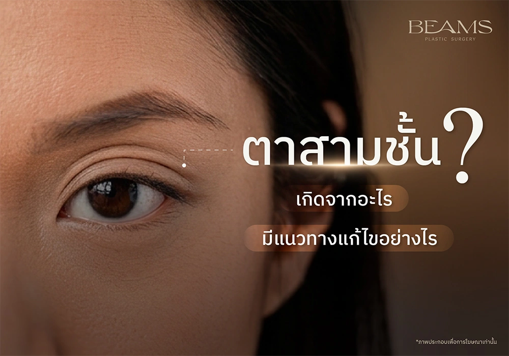 ตาสามชั้นเกิดจากอะไร