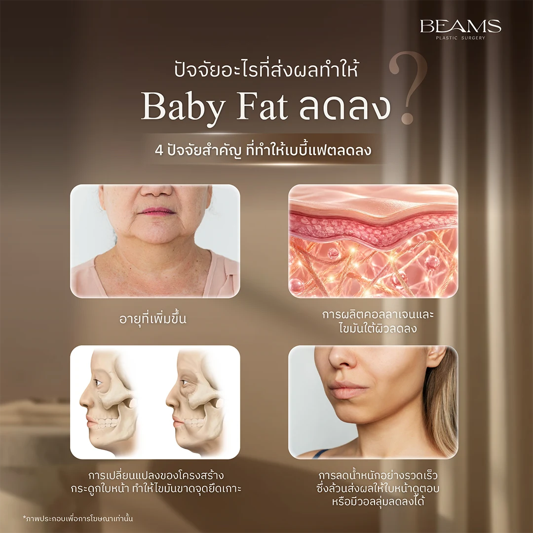 ปัจจัยที่ทำให้ Baby Fat ลดลง
