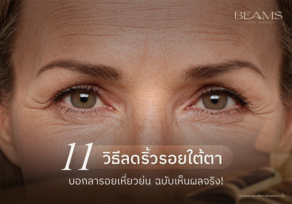 วิธีลดริ้วรอยใต้ตา
