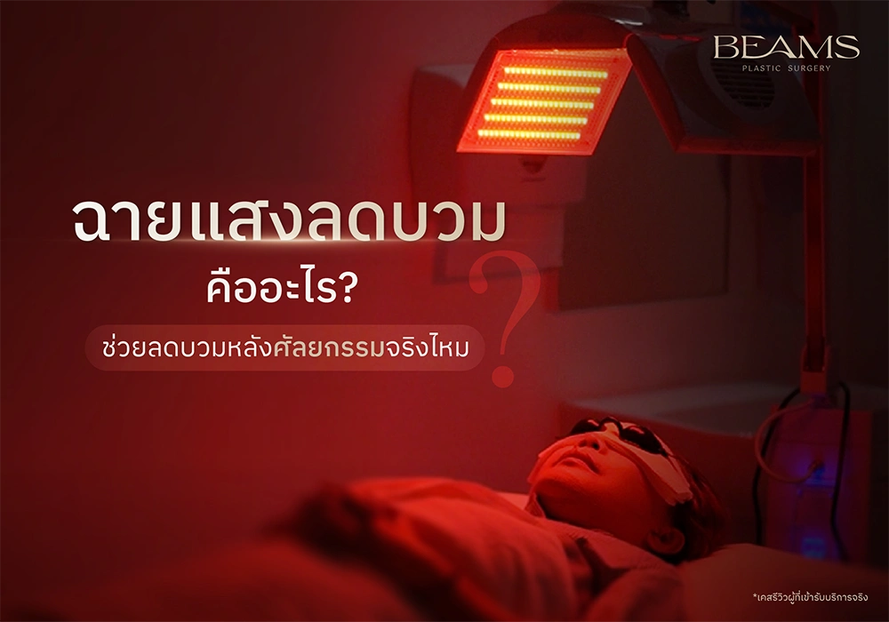 ฉายแสงลดบวมคืออะไร