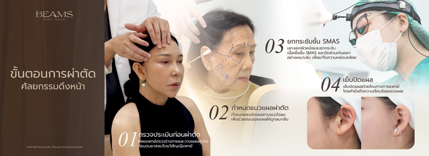 ขั้นตอนการดึงหน้า