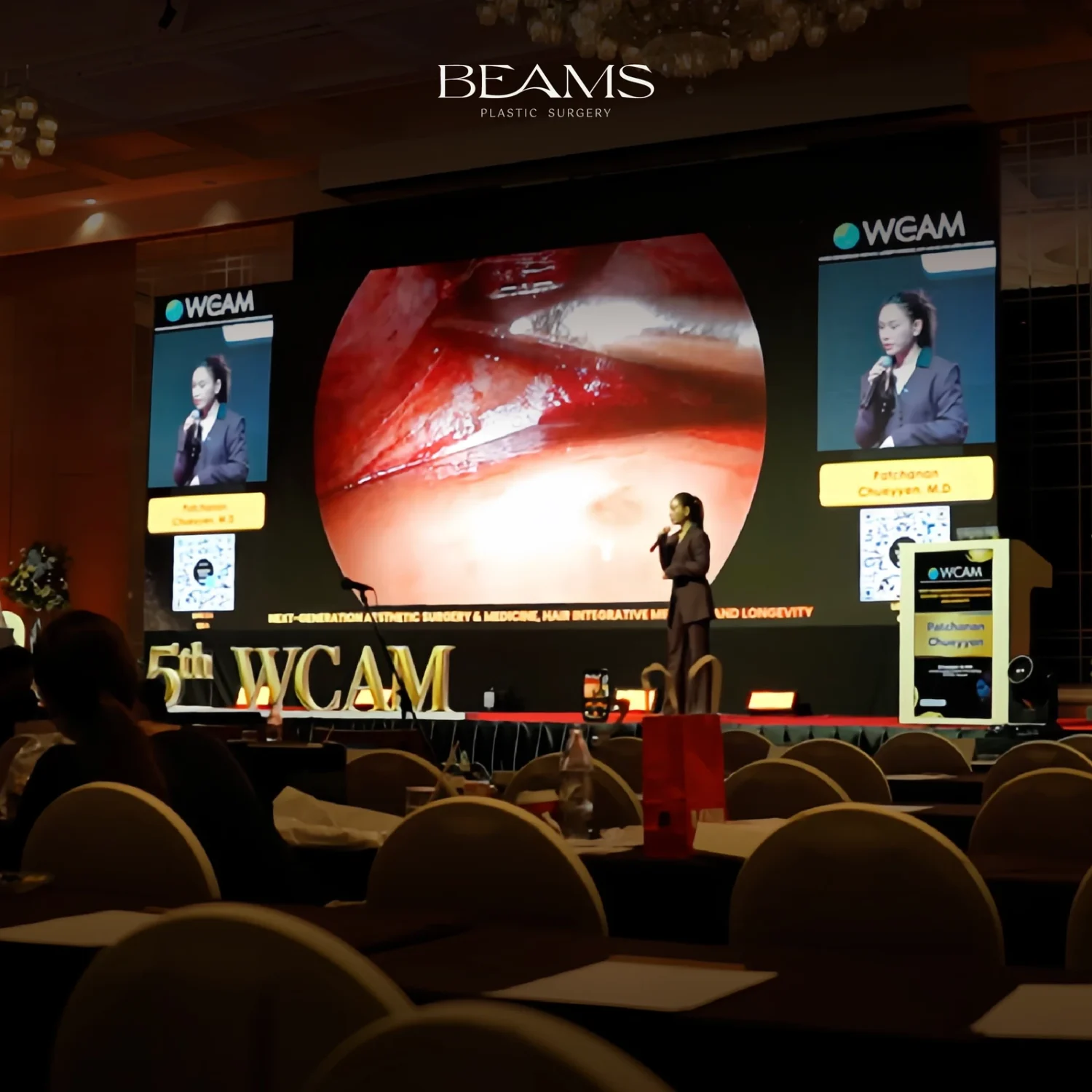 Endoscopic Browlift หัวข้อบรรยายจาก BEAMS Plastic Surgery